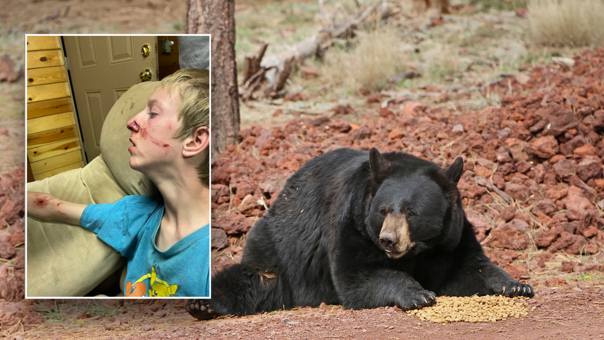 Arizona teenage survives black bear attack in Alpine: ‘A blessing’